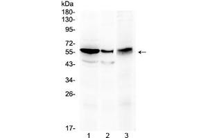 Western blot testing of 1) rat kidney, 2) mouse stomach and 3) human HepG2 lysate with ALDH1A3 antibody at 0.