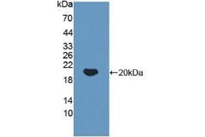 Detection of Recombinant IkBa, Human using Polyclonal Antibody to Inhibitory Subunit Of NF Kappa B Alpha (IkBa) (Inhibitory Subunit Of NF kappa B alpha (AA 74-247) Antikörper)