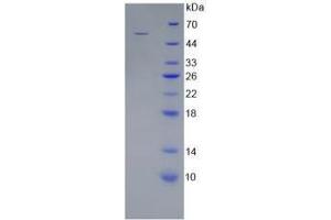 SDS-PAGE (SDS) image for Wingless-Type MMTV Integration Site Family, Member 10A (WNT10A) protein (ABIN3012218)
