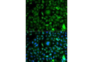 Immunofluorescence analysis of A549 cell using DPF1 antibody. (DPF1 Antikörper)