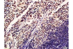 Formalin-fixed and paraffin embedded mouse spleen labeled with Rabbit Anti-SATB1 (Ser47) Polyclonal Antibody, Unconjugated 1:200 followed by conjugation to the secondary antibody and DAB staining (SATB1 Antikörper  (pSer47))