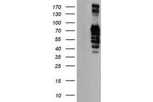 Western Blotting (WB) image for anti-Golgi Membrane Protein 1 (GOLM1) antibody (ABIN1498492)