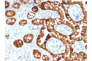 Formalin-fixed, paraffin-embedded human Small Intestine stained with SULT1E1 Mouse Monoclonal Antibody (CPTC-SULT1E1-1). (SULT1E1 Antikörper)