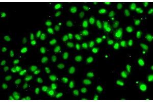 Immunofluorescence analysis of A549 cells using MEPCE Polyclonal Antibody (MEPCE Antikörper)