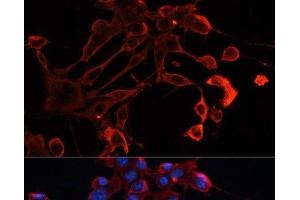 Immunofluorescence analysis of NIH/3T3 cells using ADAM11 Polyclonal Antibody at dilution of 1:100. (ADAM11 Antikörper)