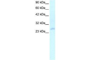 WB Suggested Anti-HOXC4 Antibody Titration:  2. (HOXC4 Antikörper  (N-Term))