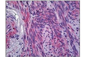 Human Uterus, Myometrium: Formalin-Fixed, Paraffin-Embedded (FFPE) (IFITM1 Antikörper)