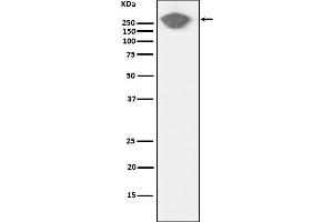 Western blot analysis of Fibronectin expression in Human serum cell lysate. (Rekombinanter Fibronectin Antikörper)