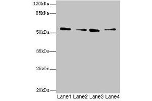 ERO1LB Antikörper  (AA 101-400)