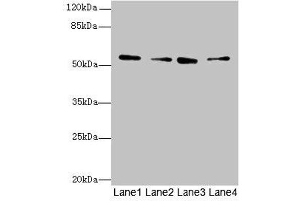 ERO1LB Antikörper  (AA 101-400)