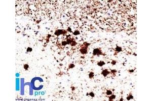 Formalin-fixed, paraffin-embedded human brain stained with Pgp9.