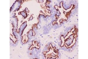 Immunohistochemistry (IHC) image for anti-Mucin 1 (MUC1) (AA 935-1097) antibody (ABIN3031862)