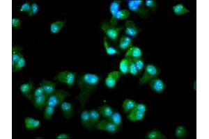 Immunofluorescence staining of MCF-7 cells with ABIN7142656 at 1:66, counter-stained with DAPI.