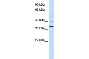 WB Suggested Anti-CRYZ Antibody Titration:  0. (CRYZ Antikörper  (Middle Region))