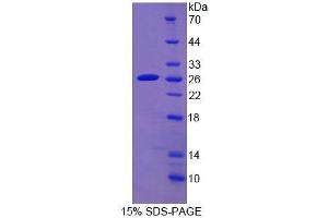 SDS-PAGE (SDS) image for Cytochrome P450, Family 2, Subfamily D, Polypeptide 6 (CYP2D6) (AA 236-472) protein (His tag) (ABIN1099018) (CYP2D6 Protein (AA 236-472) (His tag))