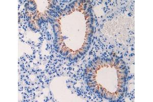 IHC-P analysis of lung tissue, with DAB staining. (CCL4 Antikörper  (AA 24-92))