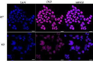 anti-CCCTC-Binding Factor (Zinc Finger Protein) (CTCF) antibody