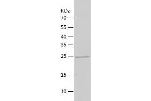 Western Blotting (WB) image for Asialoglycoprotein Receptor 2 (ASGR2) (AA 80-311) protein (His tag) (ABIN7285084) (Asialoglycoprotein Receptor 2 Protein (ASGR2) (AA 80-311) (His tag))