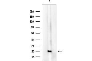 anti-Ribosomal Protein S23 (RPS23) (N-Term) antibody
