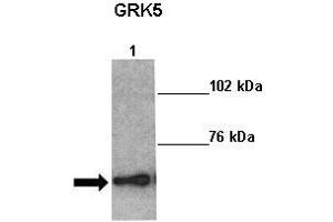 Sample Type: Lane 1:241 µg mouse left ventricle heart lysate Primary Antibody Dilution: 1:0000Secondary Antibody: Anti-rabbit-HRP Secondary Antibody Dilution: 1:0000 Color/Signal Descriptions: GRK5  Gene Name: Kathleen Gabrielson Submitted by: (GRK5 Antikörper  (Middle Region))