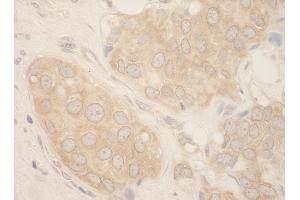 Immunohistochemistry (IHC) image for anti-SFRS Protein Kinase 2 (SRPK2) (AA 425-475) antibody (ABIN7449028) (SRPK2 Antikörper  (AA 425-475))