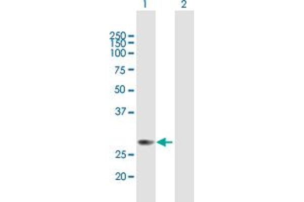 METTL6 Antikörper  (AA 1-255)