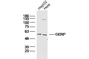 Lane 1: HepG2 lysates Lane 2: Hela lysates probed with GERP Polyclonal Antibody, Unconjugated  at 1:300 dilution and 4˚C overnight incubation. (TRIM8 Antikörper)
