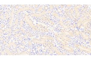 DAB staining on IHC-P;Samples: Mouse Kidney Tissue;Primary Ab: 20μg/ml Rabbit Anti-Mouse PDGFBB Antibody. (PDGF-BB Homodimer (AA 21-241) Antikörper)