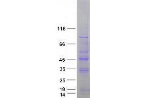 Western Blotting (WB) image for serine/threonine Kinase 19 (STK19) (Transcript Variant 1) protein (Myc-DYKDDDDK Tag) (ABIN2732864)