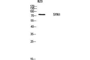 Western Blot (WB) analysis of 823 using SYN1 antibody.