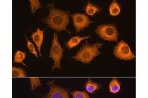 Immunofluorescence analysis of L929 cells using RIG-I / DDX58 Polyclonal Antibody at dilution of 1:100. (DDX58 Antikörper)