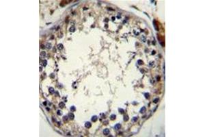 Formalin fixed and paraffin embedded human testis tissue stained with STRA8 Antibody (C-term) followed by peroxidase conjugation of the secondary antibody and DAB staining. (STRA8 Antikörper  (C-Term))