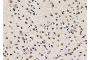 ABIN6261721 and ABIN6276601 at 1/100 staining Mouse brain tissue by IHC-P.