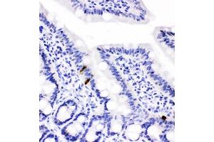 IHC analysis of Peptide YY using anti-Peptide YY antibody (ABIN4886709).