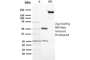 SDS-PAGE Analysis Purified ACTH Monoclonal Antibody (57). (POMC Antikörper  (N-Term))