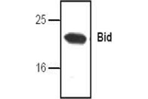 Image no. 1 for anti-BH3 Interacting Domain Death Agonist (BID) antibody (ABIN127033) (BID Antikörper)