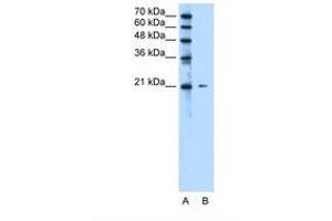 Image no. 1 for anti-Chromosome 20 Open Reading Frame 24 (C20ORF24) (N-Term) antibody (ABIN321585) (C20ORF24 Antikörper  (N-Term))