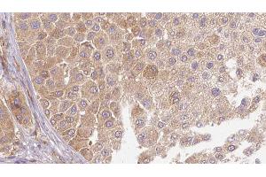 Immunohistochemistry (IHC) image for anti-Latent Transforming Growth Factor beta Binding Protein 1 (LTBP1) (C-Term) antibody (ABIN6263021)
