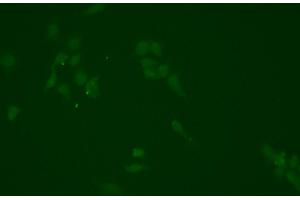 ABIN6266354 and ABIN6276702 staining HEPG2 cells by ICC/IF.