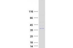 Validation with Western Blot (ELMOD1 Protein (Transcript Variant 1) (Myc-DYKDDDDK Tag))
