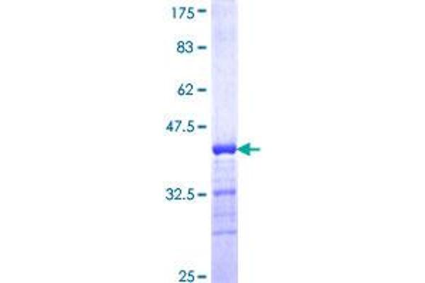 IFT88 Protein (AA 724-833) (GST tag)