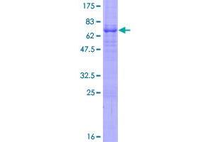 Image no. 1 for Ephrin B1 (EFNB1) (AA 1-346) protein (GST tag) (ABIN1352407) (Ephrin B1 Protein (EFNB1) (AA 1-346) (GST tag))