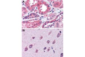 Immunohistochemical staining of formalin-fixed, paraffin-embedded human kidney (A) and human brain, cortex (B) tissue after heat-induced antigen retrieval. (IGSF8 Antikörper  (Internal Region))