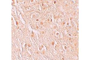 Immunohistochemistry (IHC) image for anti-Pigeon Homolog (PION) (C-Term) antibody (ABIN1030587) (GSAP Antikörper  (C-Term))