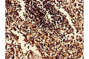 Immunohistochemistry of paraffin-embedded human spleen tissue using ABIN7152137 at dilution of 1:100 (EIF2AK1 Antikörper  (AA 1-86))
