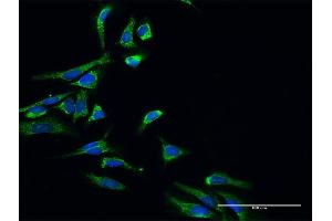 Immunofluorescence of purified MaxPab antibody to HSD17B10 on HeLa cell. (HSD17B10 Antikörper  (AA 1-261))