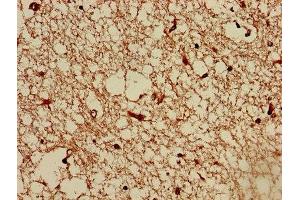 Immunohistochemistry of paraffin-embedded human brain tissue using ABIN7173087 at dilution of 1:100 (TMEM161B Antikörper  (AA 1-487))