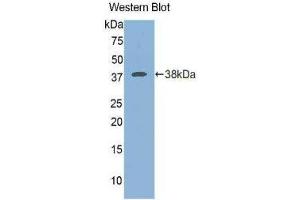 Western Blotting (WB) image for anti-Islet Cell Autoantigen 1, 69kDa (ICA1) (AA 1-257) antibody (ABIN1175749)