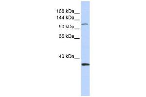 MCM2 antibody used at 1 ug/ml to detect target protein. (MCM2 Antikörper  (Middle Region))