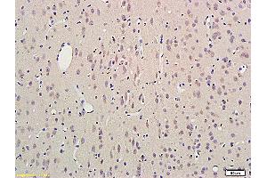 Formalin-fixed and paraffin embedded rat brain labeled with Anti SCN3B Polyclonal Antibody, Unconjugated (ABIN872574) followed by conjugation to the secondary antibody and DAB staining (SCN3B Antikörper  (AA 21-120))
